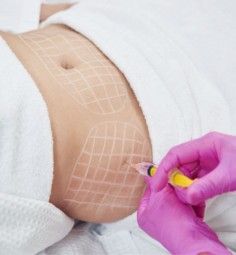 Remodelación coprporal en clínica estética RS de Eibar